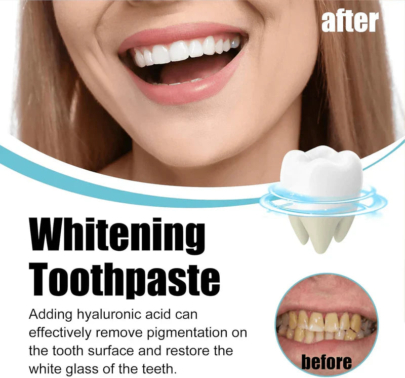 Scoban - Teeth Whitening (Original)